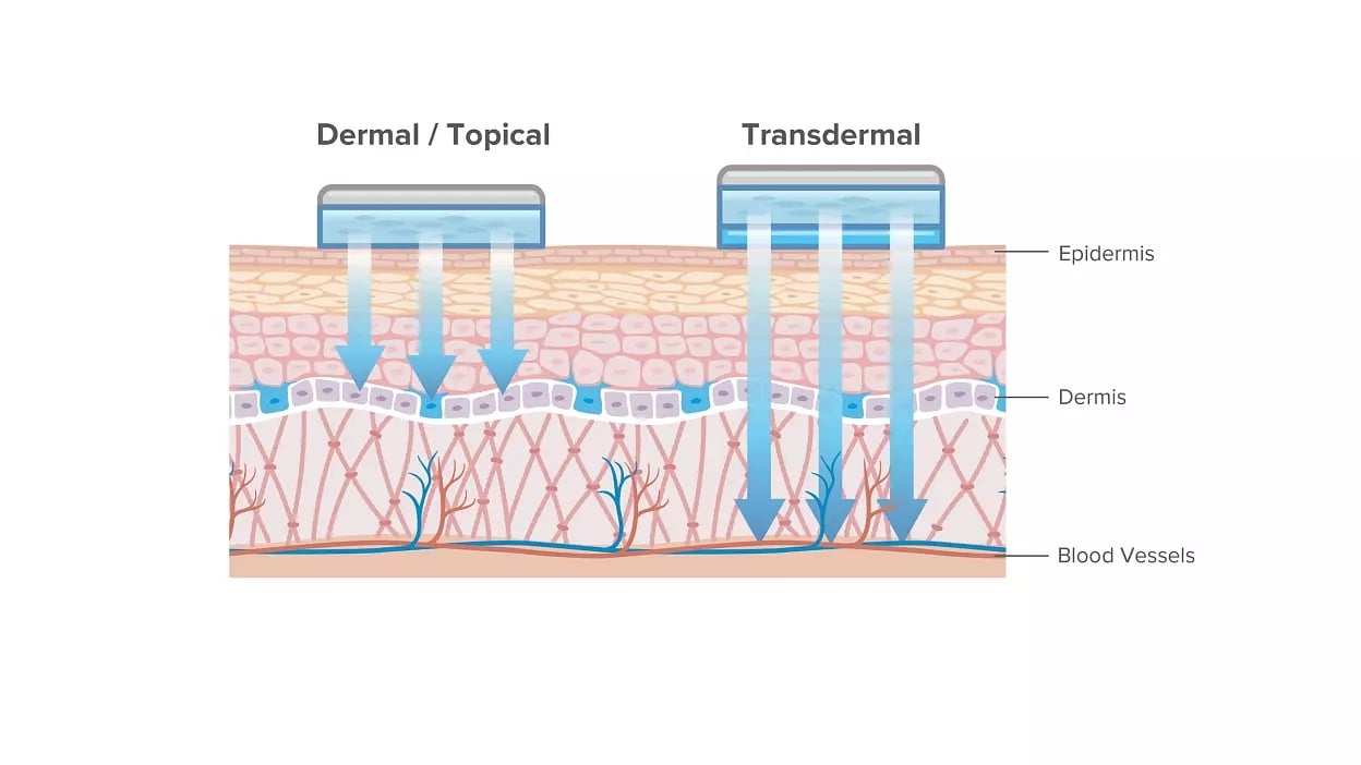 Dermal drug delivery systems